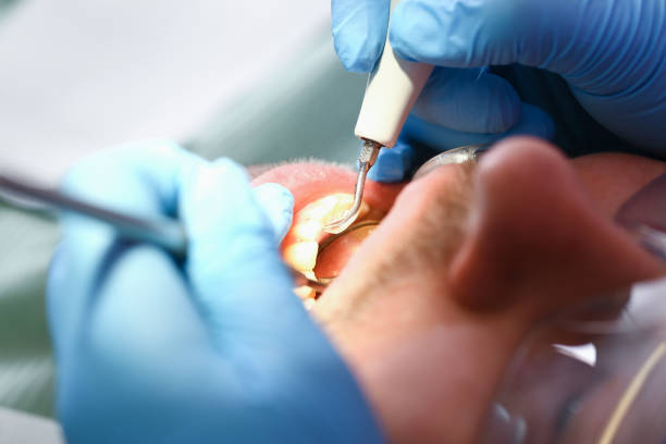 Best Pediatric Emergency Dentist in Elmer, NJ